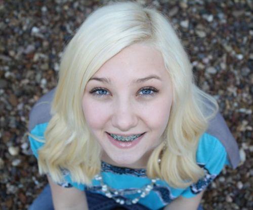 Blonde girl with Blue Eyes and Braces Looking Up