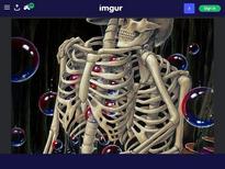 Hasn't been deleted vaga. Image of two skeletons by Joyce lee according to the signature 