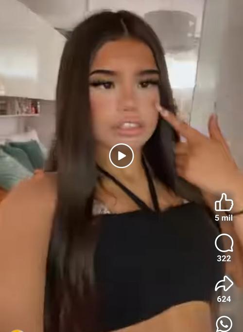 What is the name of this crosseyed girl?